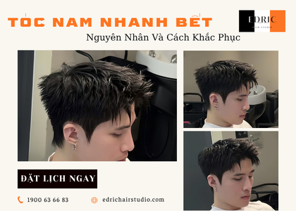 Tóc Nam Nhanh Bết – Nguyên Nhân & Cách Khắc Phục